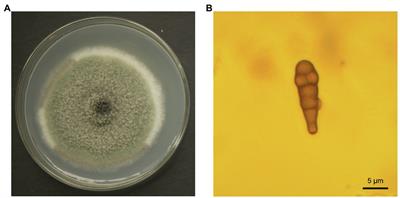 Whole Genome Sequence of Alternaria alternata, the Causal Agent of <mark class="highlighted">Black Spot</mark> of Kiwifruit